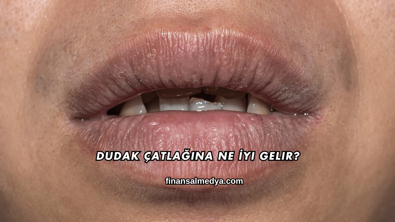 Dudak Çatlağına Ne İyi Gelir?