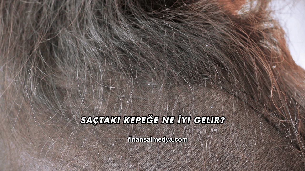 Saçtaki Kepeğe Ne İyi Gelir?