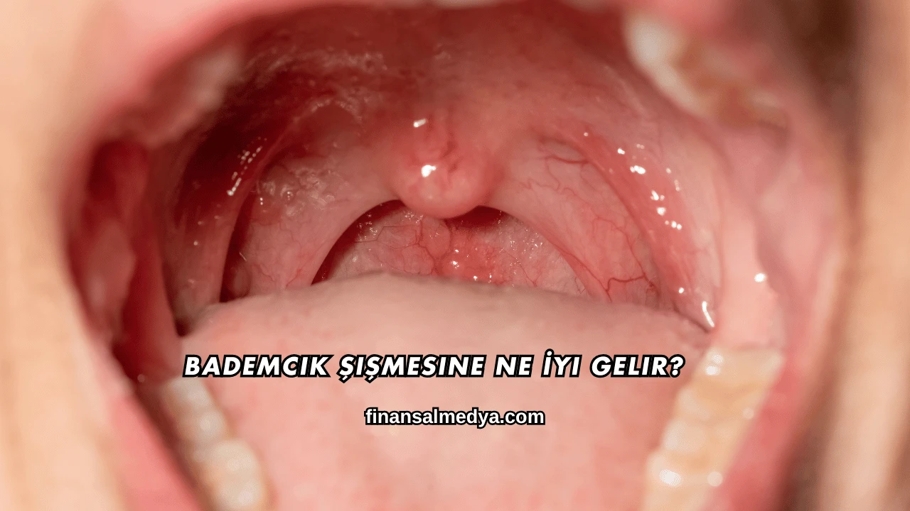 Bademcik Şişmesine Ne İyi Gelir?