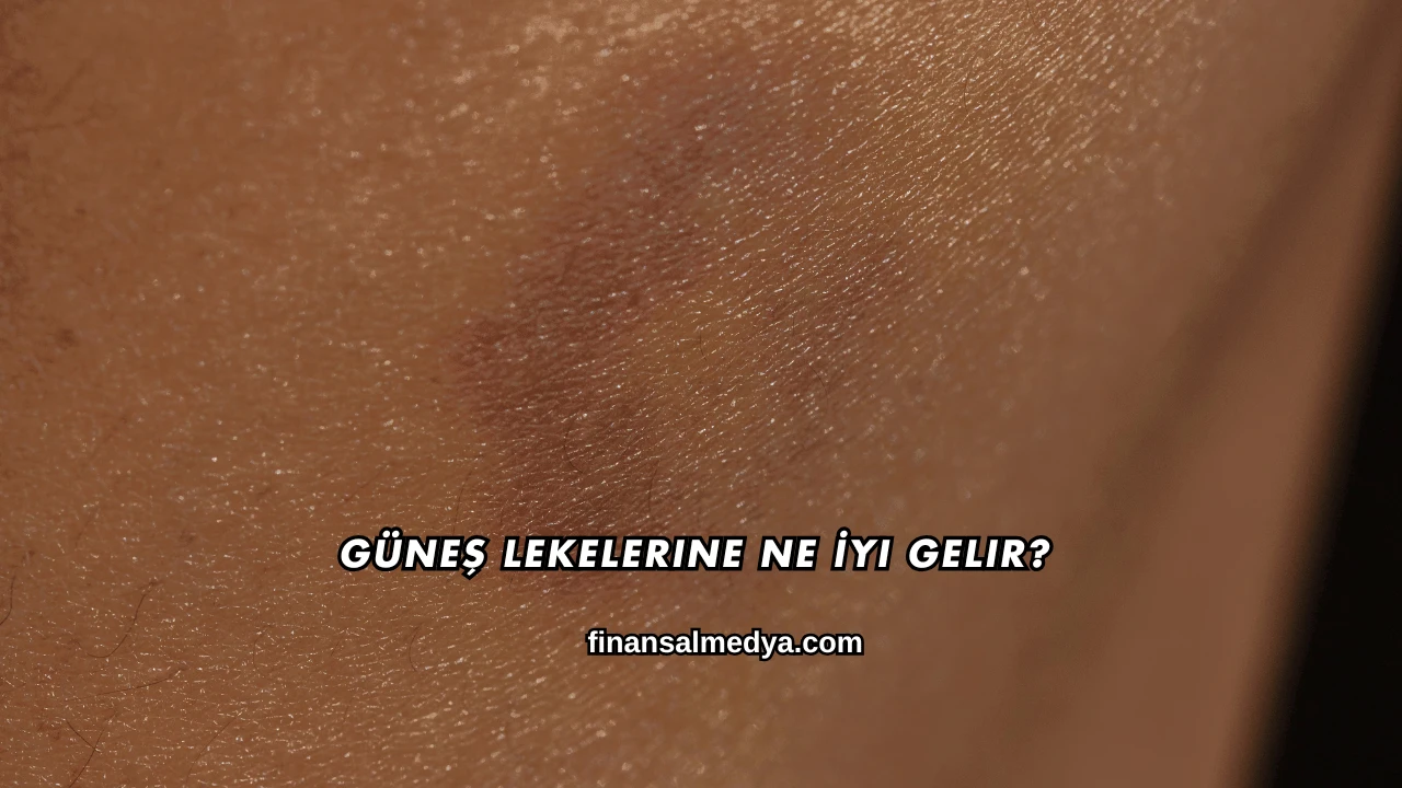 Güneş Lekelerine Ne İyi Gelir?