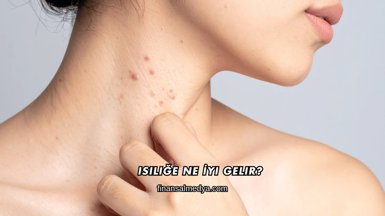 Isiliğe Ne İyi Gelir?