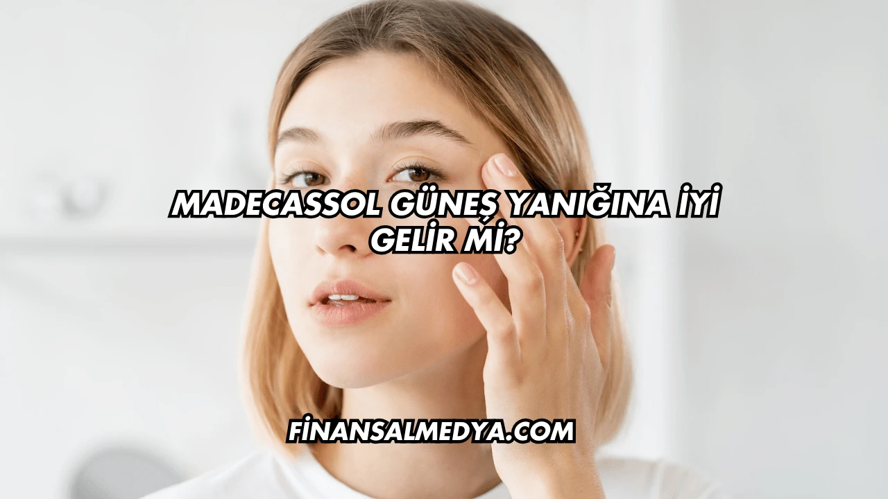 Madecassol Güneş Yanığına İyi Gelir mi?