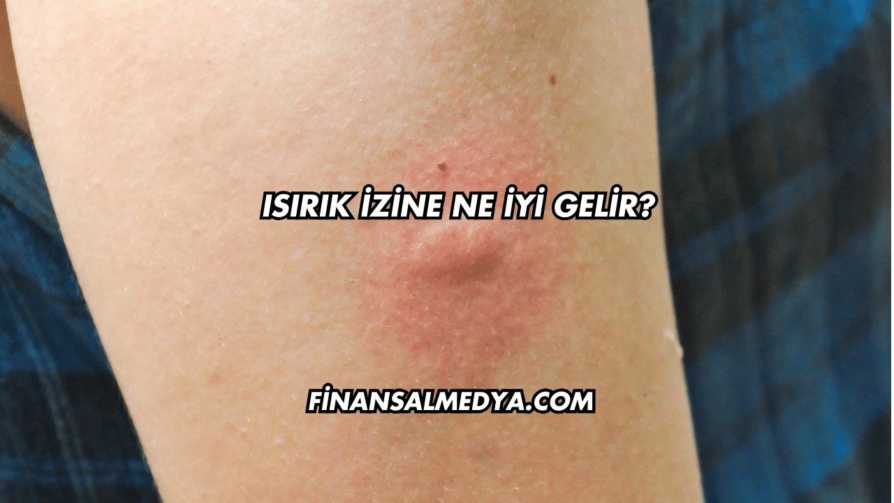 Isırık İzine Ne İyi Gelir?