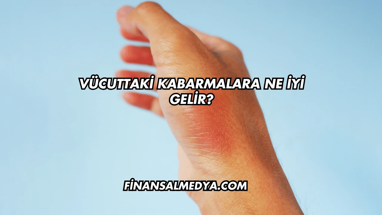 Vücuttaki Kabarmalara Ne İyi Gelir?