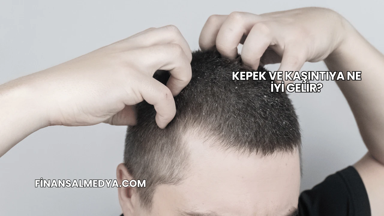 Kepek ve Kaşıntıya Ne İyi Gelir?