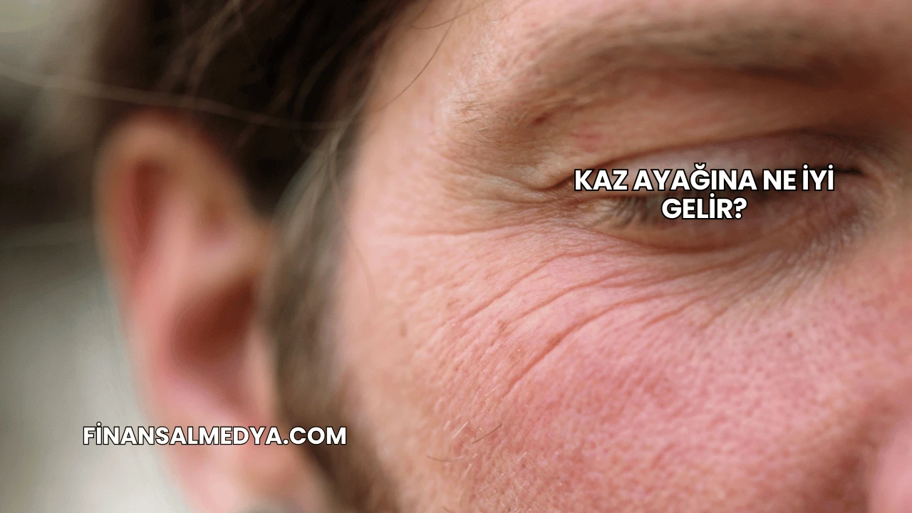 Kaz Ayağına Ne İyi Gelir?