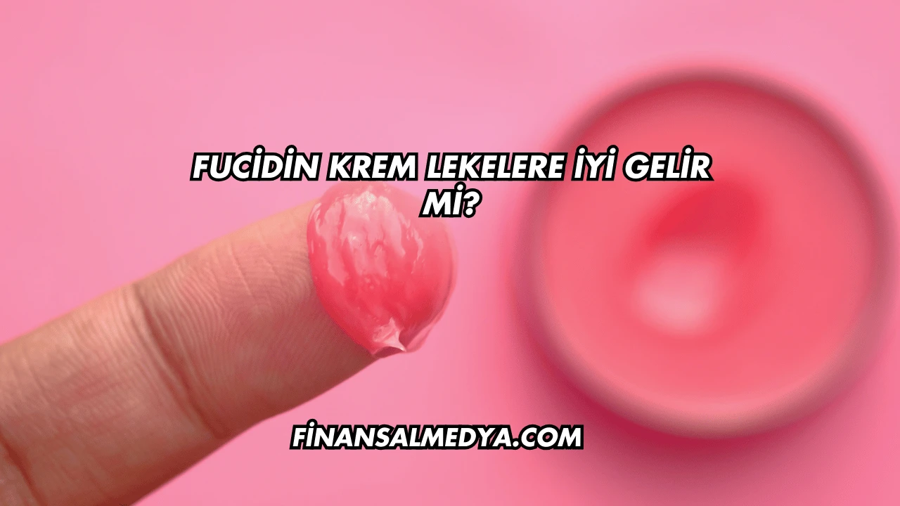 Fucidin Krem Lekelere İyi Gelir mi?