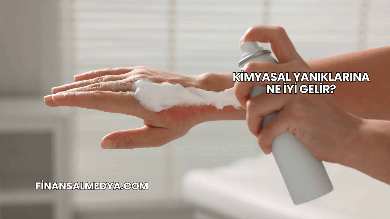 Kimyasal Yanıklarına Ne İyi Gelir?
