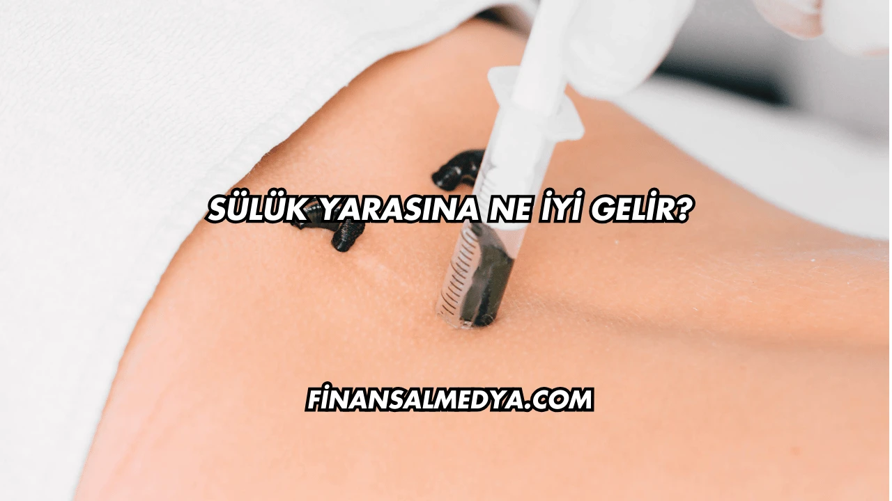 Sülük Yarasına Ne İyi Gelir?
