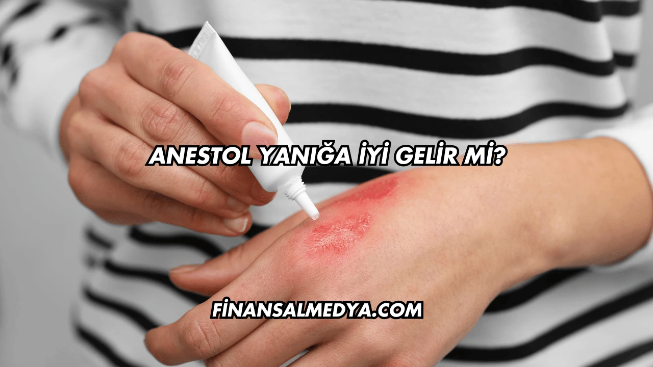 Anestol Yanığa İyi Gelir mi?