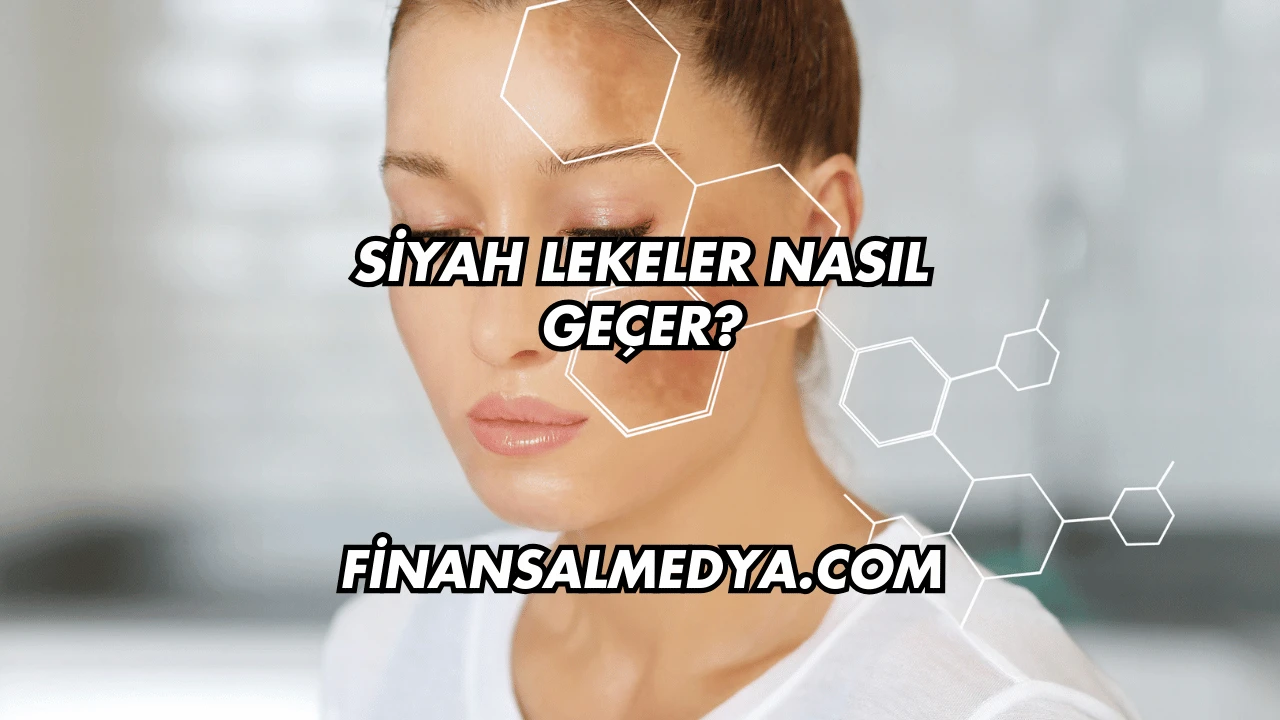 Siyah Lekeler Nasıl Geçer?