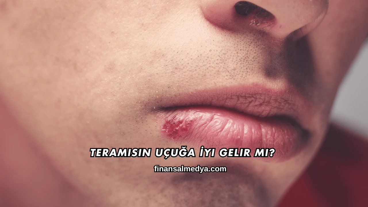 Teramisin Uçuğa İyi Gelir mi?