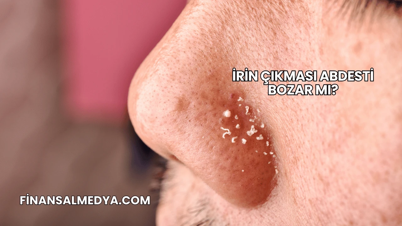 İrin Çıkması Abdesti Bozar mı?