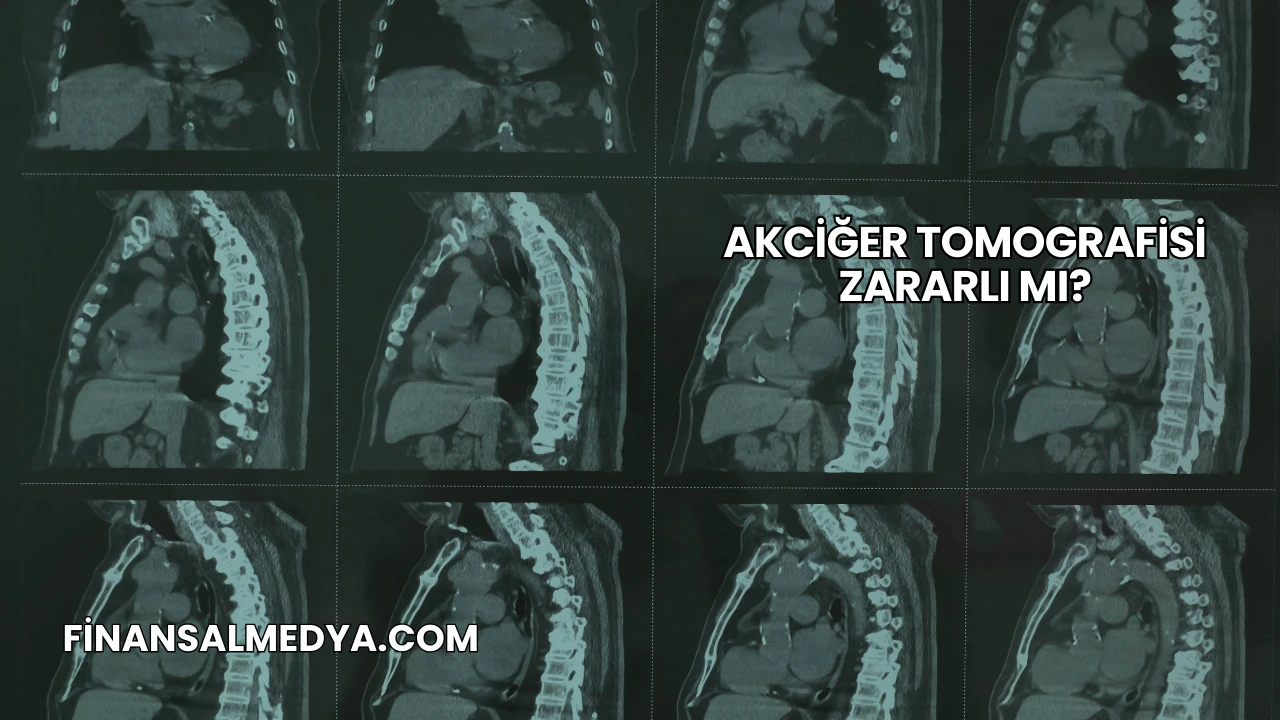 Akciğer Tomografisi Zararlı mı?