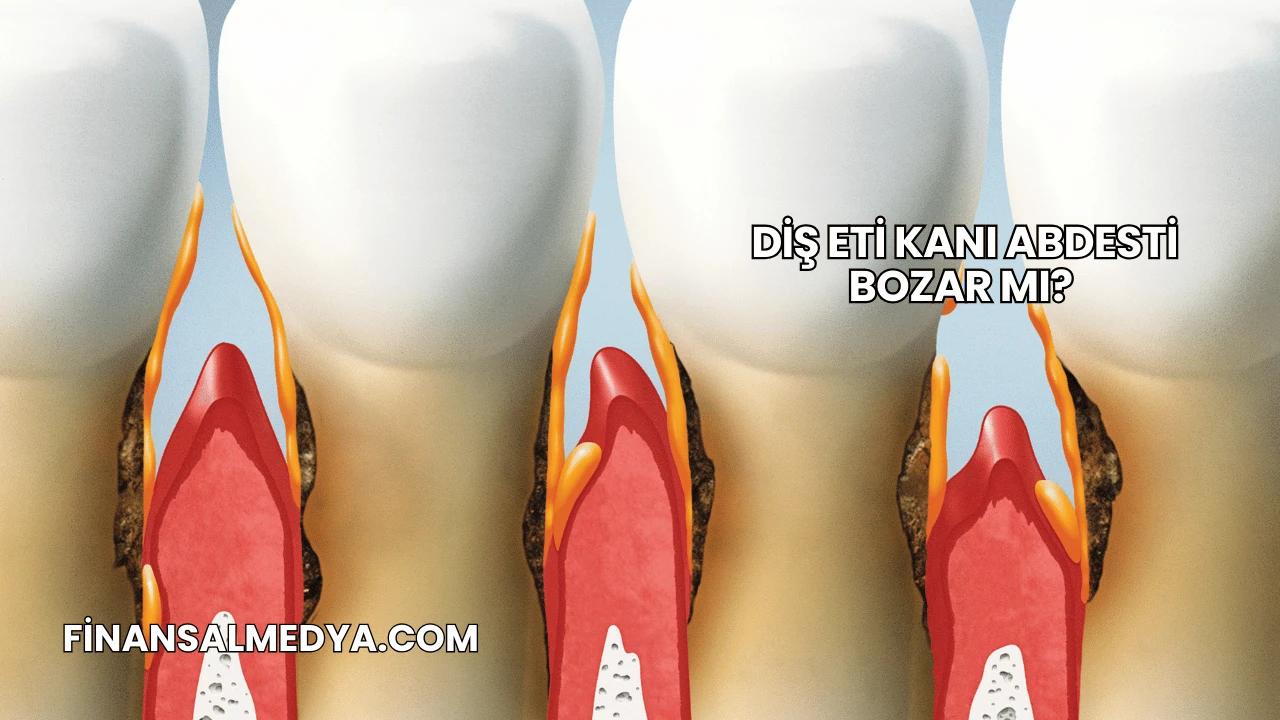 Diş Eti Kanı Abdesti Bozar mı?