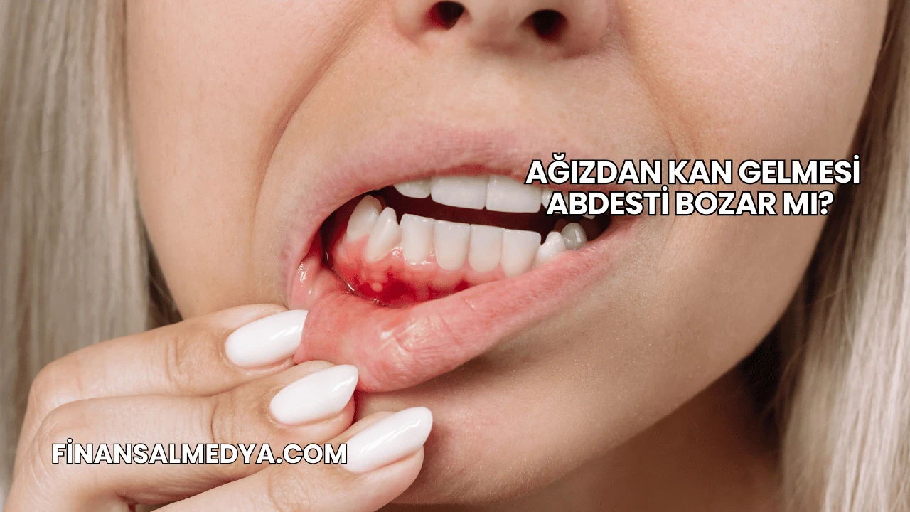 Ağızdan Kan Gelmesi Abdesti Bozar mı?