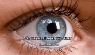 Göz Yanmasına Ne İyi Gelir?