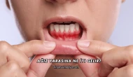 Ağız Yarasına Ne İyi Gelir?