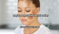 Yaşlılık Lekelerine Ne İyi Gelir?