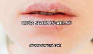 Uçuğa Vazelin İyi Gelir mi?