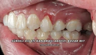 Sürekli Diş Eti Kanaması Abdesti Bozar mı?