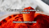 Acı Biberden Eli Yanan Ne Yapmalı?