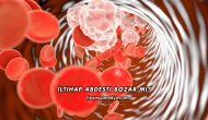 İltihap Abdesti Bozar mı?
