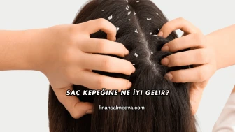 Saç Kepeğine Ne İyi Gelir?