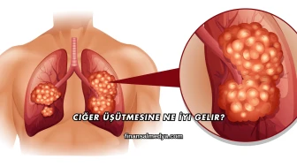 Ciğer Üşütmesine Ne İyi Gelir?