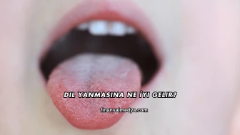Dil Yanmasına Ne İyi Gelir?
