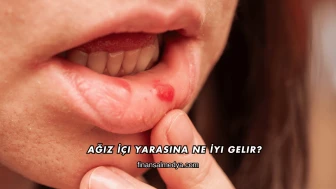 Ağız İçi Yarasına Ne İyi Gelir?