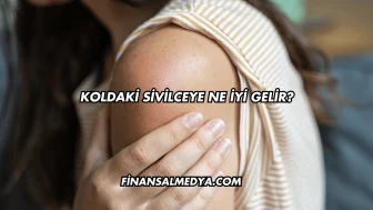 Koldaki Sivilceye Ne İyi Gelir?