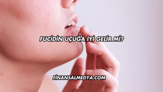 Fucidin Uçuğa İyi Gelir mi?