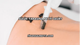 Sülük Yarasına Ne İyi Gelir?