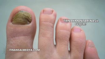 Tırnak Mantarı Nasıl Geçer?