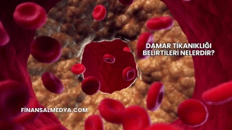 Damar Tıkanıklığı Belirtileri Nelerdir?