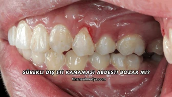 Sürekli Diş Eti Kanaması Abdesti Bozar mı?