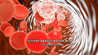 İltihap Abdesti Bozar mı?