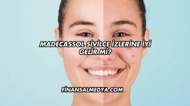 Madecassol Sivilce İzlerine İyi Gelir mi?