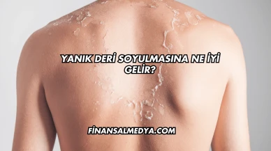 Yanık Deri Soyulmasına Ne İyi Gelir?