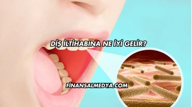 Diş İltihabına Ne İyi Gelir?