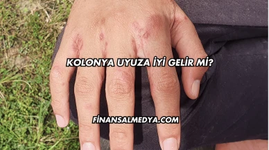 Kolonya Uyuza İyi Gelir mi?
