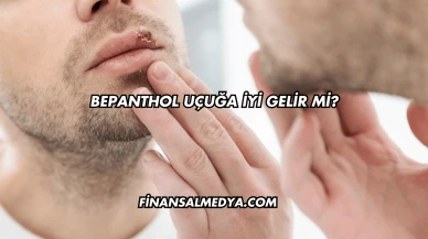 Bepanthol Uçuğa İyi Gelir mi?