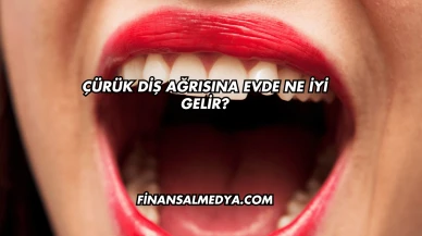 Çürük Diş Ağrısına Evde Ne İyi Gelir?