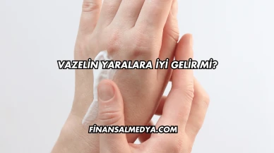 Vazelin Yaralara İyi Gelir mi?