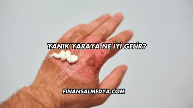 Yanık Yaraya Ne İyi Gelir?