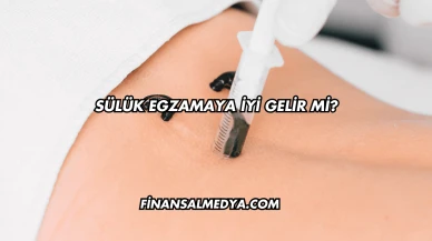 Sülük Egzamaya İyi Gelir mi?