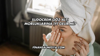 Sudocrem Göz Altı Morluklarına İyi Gelir mi?