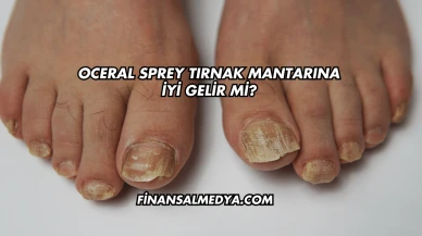Oceral Sprey Tırnak Mantarına İyi Gelir mi?