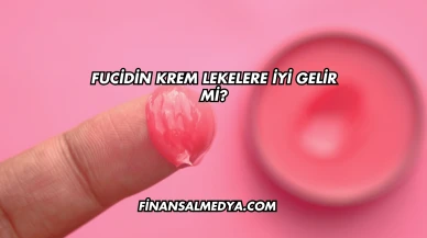 Fucidin Krem Lekelere İyi Gelir mi?